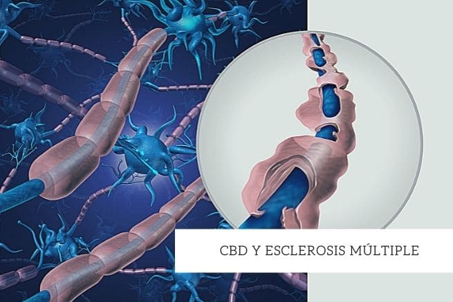 cbd y esclerosis multiple