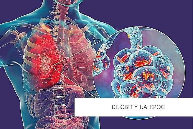 cbd y epoc