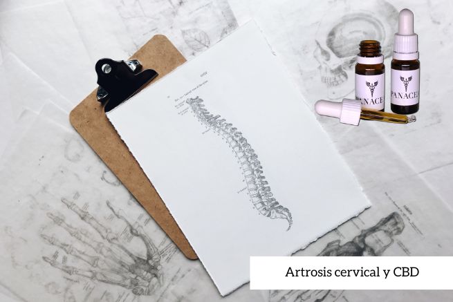 Artrosis cervical y CBD